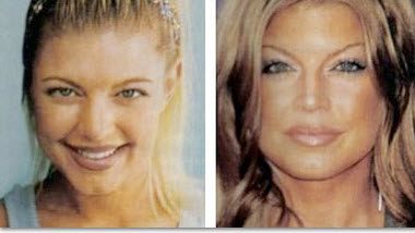 Temecula Body Contouring | Plastic Surgery