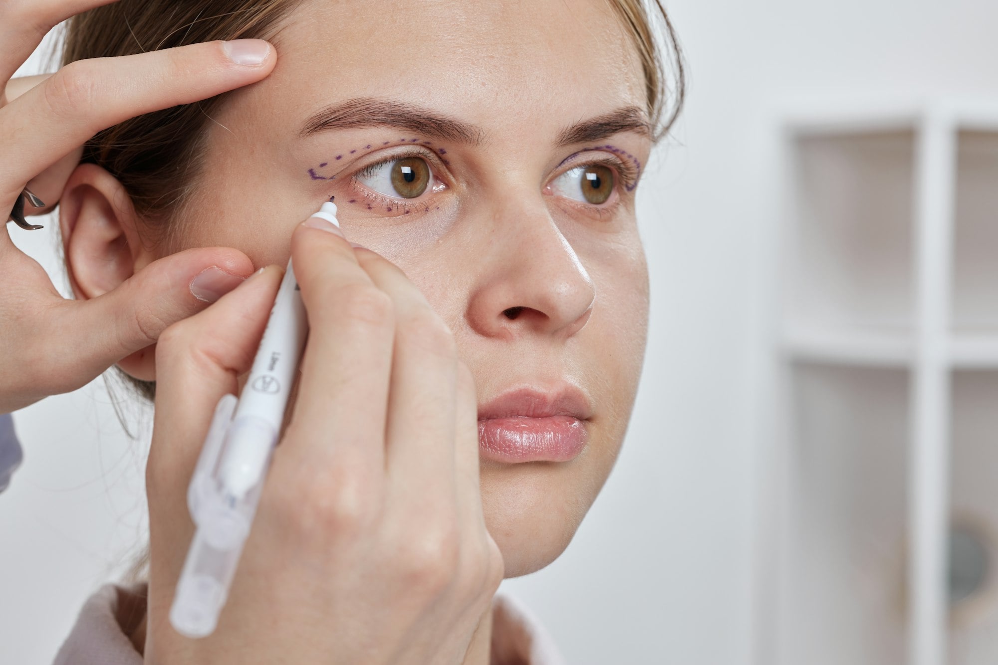 Blepharoplasty Insights in Temecula: Your Guide to Cosmetic Surgery and Med-Spa Excellence