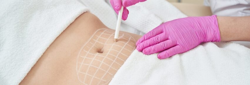 Temecula Body Contouring | Plastic Surgery