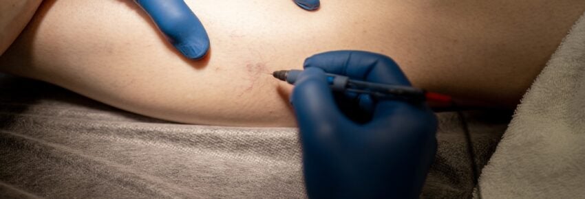 Temecula Body Contouring | Plastic Surgery
