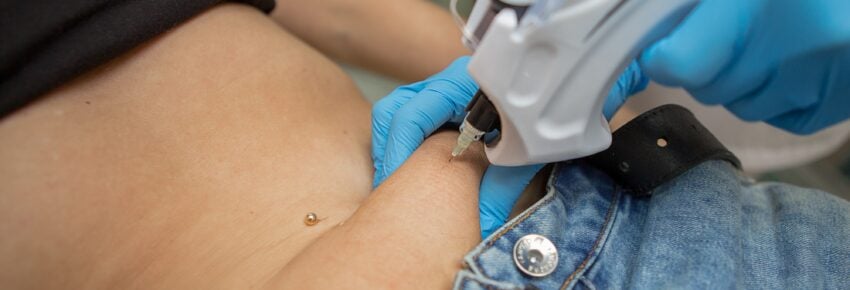 Temecula Body Contouring | Plastic Surgery