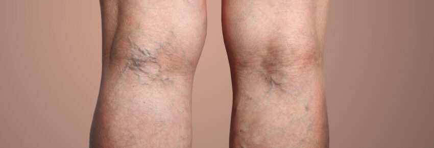 Temecula Body Contouring | Plastic Surgery