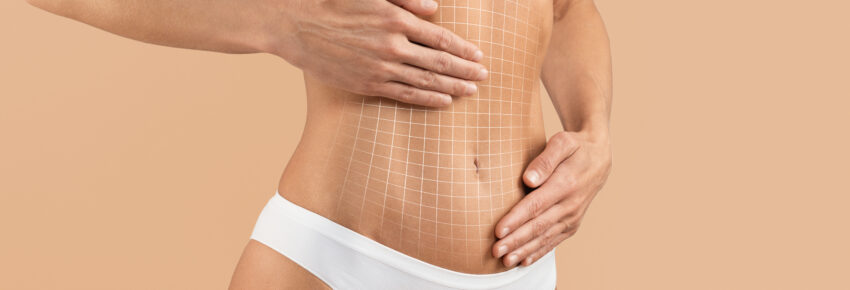 Temecula Body Contouring | Plastic Surgery